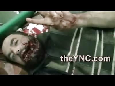 Man with Face Split Wide Open throws the Peace Sign