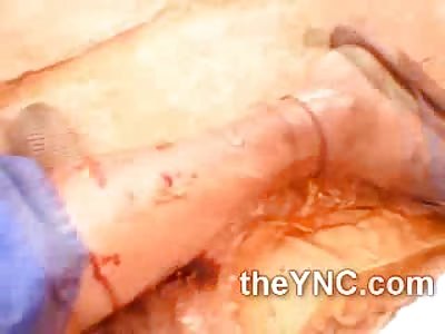 Woman does Bizarre Dance Reaction to Man Riddled with Bullet Wounds