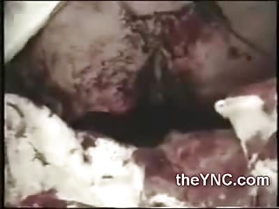 WEEKEND UPDATE: Self Inflicted Shotgun Wound Man Still Alive in Hospital