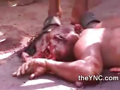 Man Run Over on the Street now Resmebles the Elephant Man