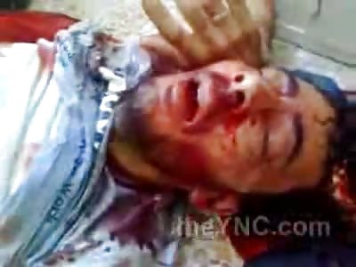 Man has his Brain Exposed as he tries to Talk to Cameraman