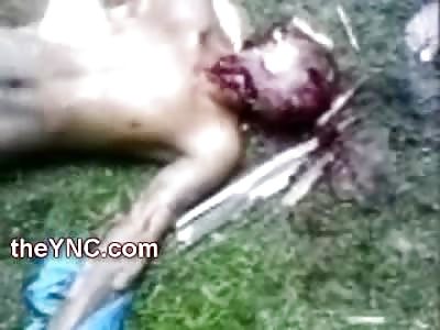 Extremely Graphic Video shows a Man Squealing with Slit Throat as Crowd Cheers, Kicks and Records him with Cell Phone (High Warning, Very Graphic Video, Watch FULL VIdeo)
