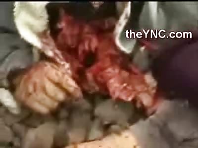 Man in Hawaii Shorts has his Head Resting on his Own Arm