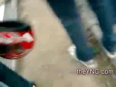 Hitting a Telephone Pole at 120 MPH Split's your Face like This......