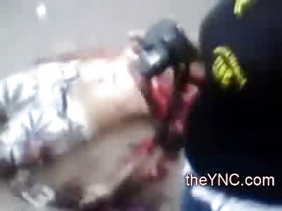 Biker is just a Mangled Bag of Bones after Fatal Accident