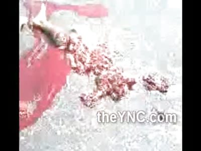 Extraordinary: Man Ripped Completely in Half Still Alive Gasping For his Last Breath  