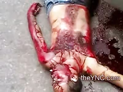 Tire Treads on the Chest Fatality is Removed from the Road