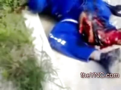 Biker with Compund Fracture waits in Shock for Help to Arrive