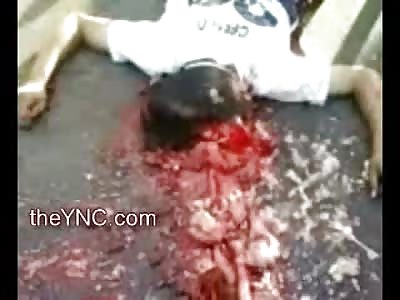 Alright this Man is DEAD and he has a Lot of Brains