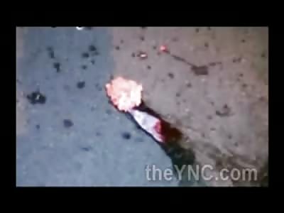 His Foots Ok ....but His Brains Don't Belong there