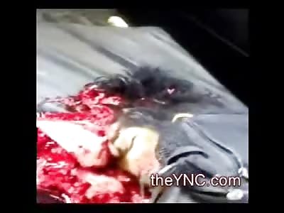 A Mess: Man on Hospital Gurney with Exploded Head is recorded by Curious Kids