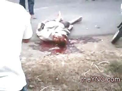 Get yourCell Phone! Man taking Final Breaths becomes a Spectacle for the Spectators