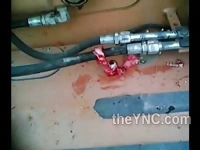 Here's Looking at You Kid!......Motorcyclists Eye Literally Pops out of the Socket During Fatal Crash