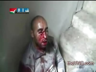 The Face of Terror, Man is Shock sits next to his Bullet Riddled Partner