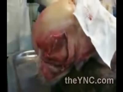 Ever Wanted to Learn how to Scalp Someone and Tear their Brains out?