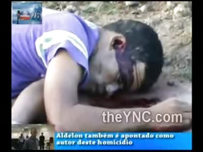 Eye Popping Accident