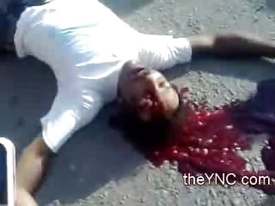 Hole in the Head and Gobs of Coagulated Blood