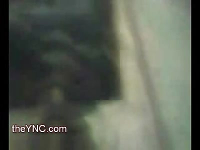 Horrific Work Injury: Man gets Wound up in a Cable Pulley