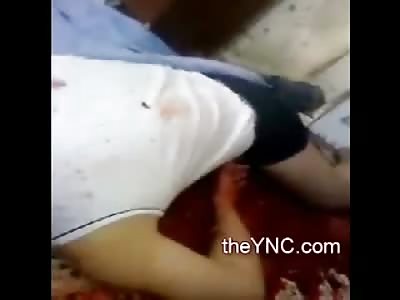 A Wimpering Allah Akbar from Cameraman, Captures Mans Head Blown up like a Melon