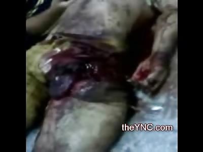 Meat  and Bones, Family looks over Man in pieces on the Morgue Table