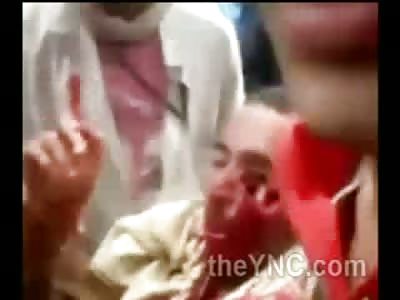 Poor Kids Eye Shot out of his Head.....Damn!!!