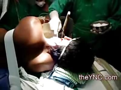 Man with Knife stuck in his Cervical wants Help