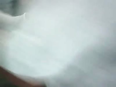 Man with Gaping Shoulder Wound in Hospital