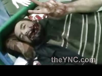 Man with His Mouth Blown out isn't Doing so Bad....Throws up the Peace Sign