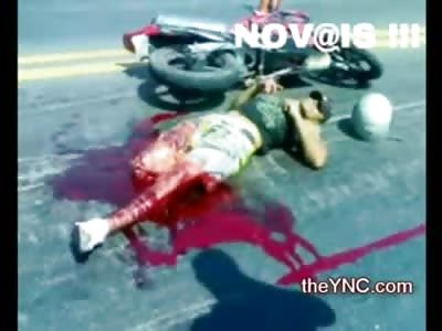 Keep it Elevated, Man with Severed Leg on his Back in the Street