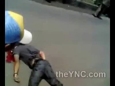 Poor Kid hit So Hard his Eyeball Popped out of his Head