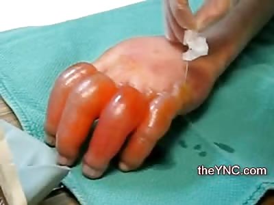 Frostbite never looked so Bad