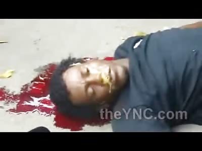 WTMF? Kid Fighting to Stay Alive on the Street Bleeds out and Has Bizarre Yellow Foam Pouring out of His Face