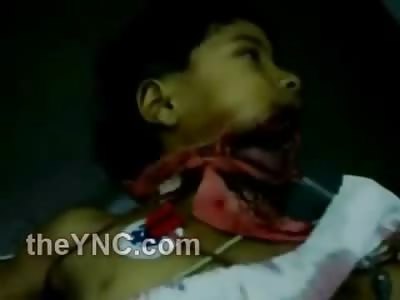 New Video Footage of Kid with his Jaw Falling Off on a Hospital Bed Cries for His Mom