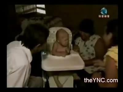 31 Year Old Woman has Bizarre Disease that Keeps her as an Infant