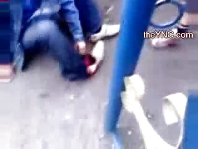 Man with Cut Off Foot by Train might Want to Take Off his Sock