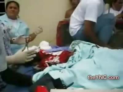 Public Surgery: Groaning Man has Gruesome Leg Injury in Back of Pick up Truck 