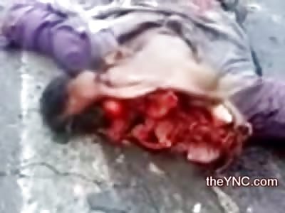 Head and Skull Opened Wide in Gruesome Aftermath