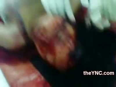 Creepy Video of Man and Girlfriend that were Brutally Beaten to Death (Woman having her Ear Sewn Back On)