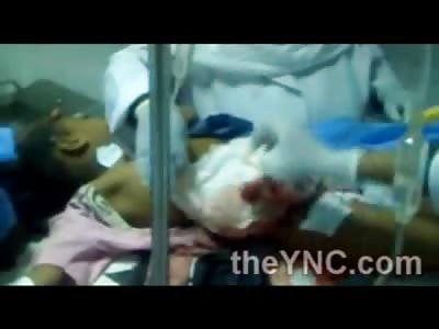 SAD: Poor Girl Lays Crying on Table While Her Guts Poor out of her Body..... ;(