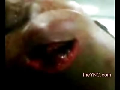 Man lies Silent and Sliced up from Horrfic Knife Attack