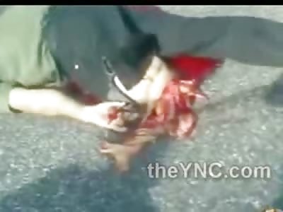 Legs Mangled and Dragged Along the Road...OUCH!!!