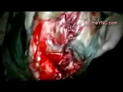 Cameraman gives You a Disgusting Aerial View of Elderly Man with a Vacant Skull