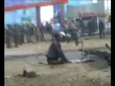 Man carrying a Bomb on his Vehicle Loses his Legs in Blast and Dies on the Way to the Hospital