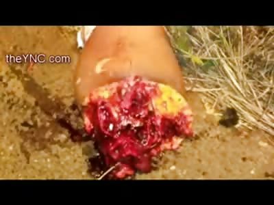 Still Glistening Blood..Female in Black Thong Ripped Apart in the Street