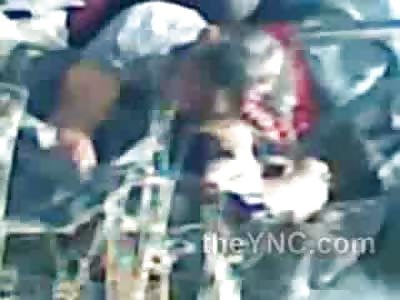 Jacked Dude Wasn't Strong Enough To Survive Horrific Head Splitting Accident 