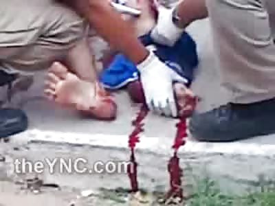 Transvestite Looking Woman has Some Foot Issues