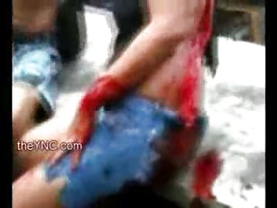 More Shocking Footage of Woman Split Open from Machete Attack standing in Shock