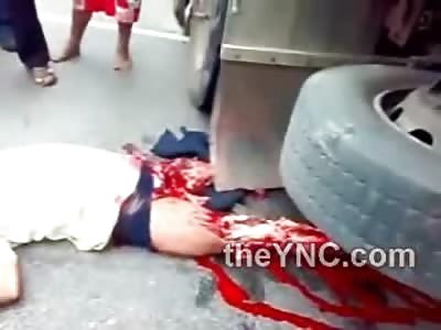 Man Suffers Horrific Leg Mangling underneath Truck
