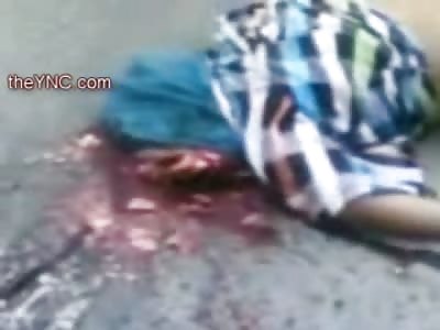 What Happens when the Helmet Breaks?