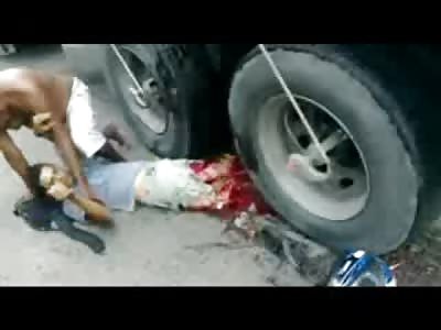 Man in Shock has Legs Shredded like Pulled Pork